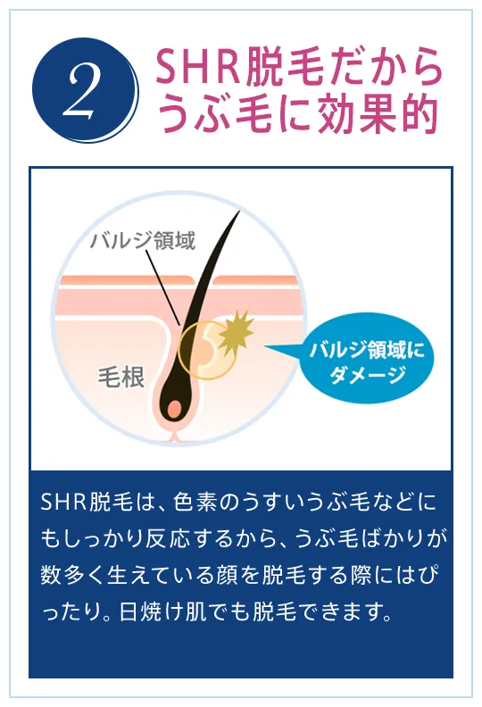 2. SHR脱毛だからうぶ毛に効果的