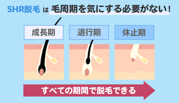 SHR脱毛の特徴