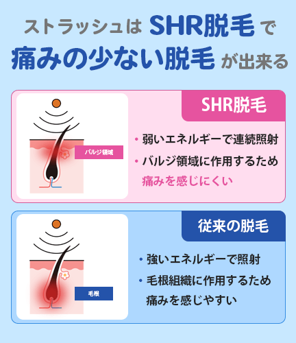 ストラッシュのSHR脱毛について