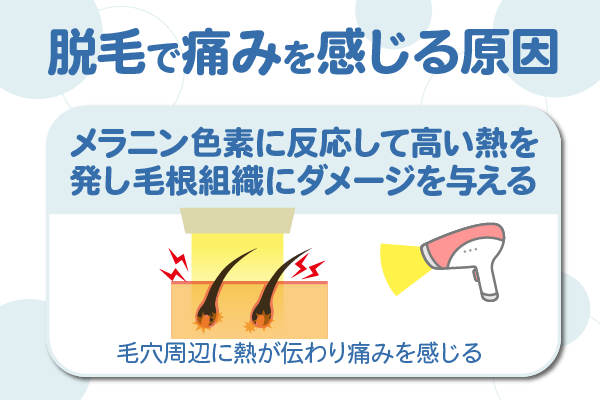 脱毛で痛みを感じる原因