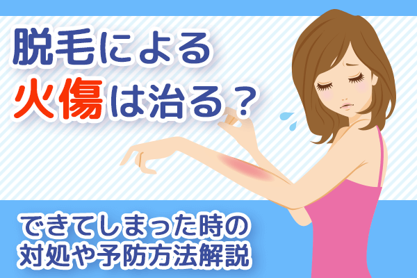 脱毛による火傷は治る？