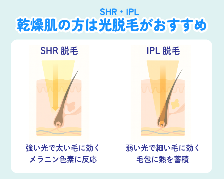 乾燥肌の方には肌への負担が少ない光脱毛(SHR・IPL)がおすすめ
