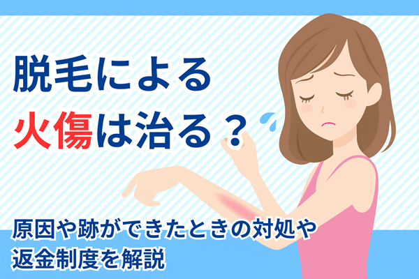 脱毛による火傷は治る?原因や跡ができたときの対処や返金制度を解説