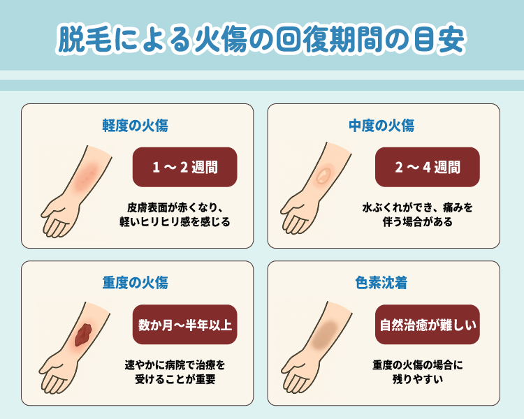 【症状別】脱毛による火傷の回復期間