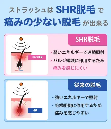 ストラッシュのSHR脱毛について